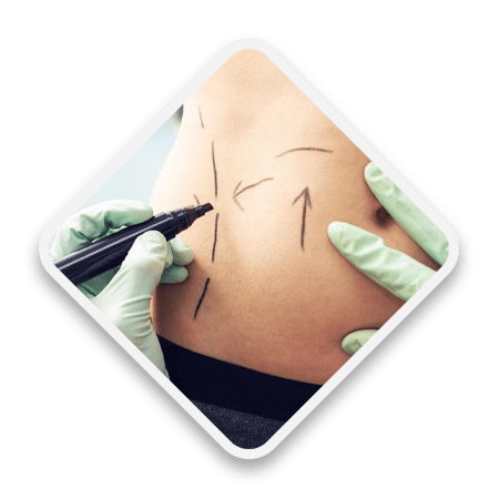 Cosmetic Surgery in Ongole